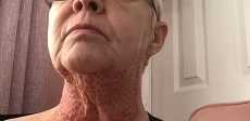 عمليات التجميل