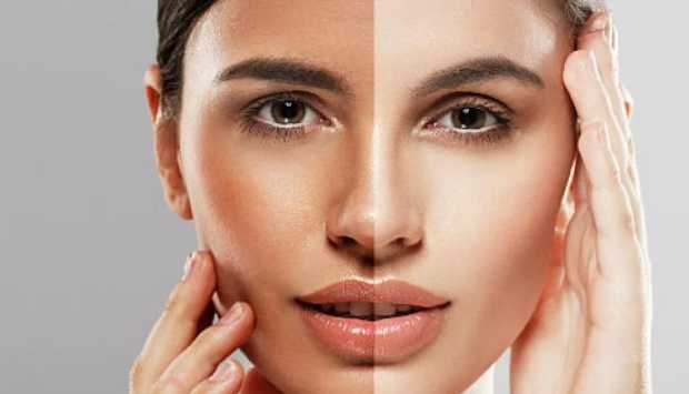 3 طرق آمنة وفعالة لـ تفتيح البشرة والتخلص من البقع الداكنة 