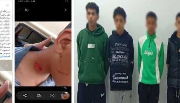 أمن الشرقية يضبط 7 طلاب اعتدوا على زميلهم بـ«زجاجة مكسورة» في الشرقية 