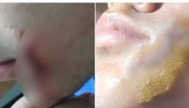 مشادة لهو تنتهي بإصابة طالب في كفر الدوار 