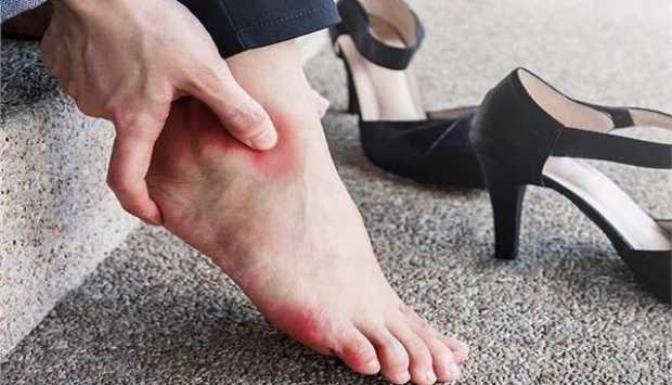 من الثلج إلى معجون الأسنان.. حيل ذكية لعلاج «عضة الحذاء» في المنزل 