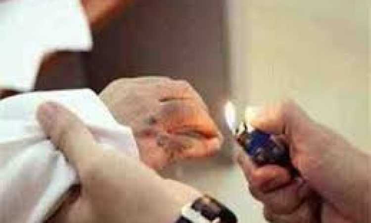 تعذيب طفلة - صورة أرشيفية