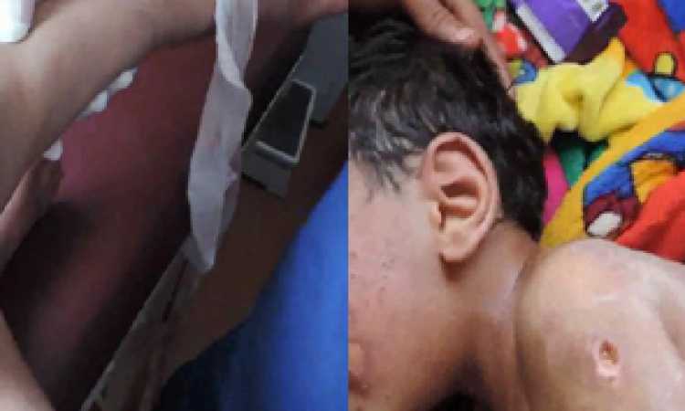 تعذيب طفل