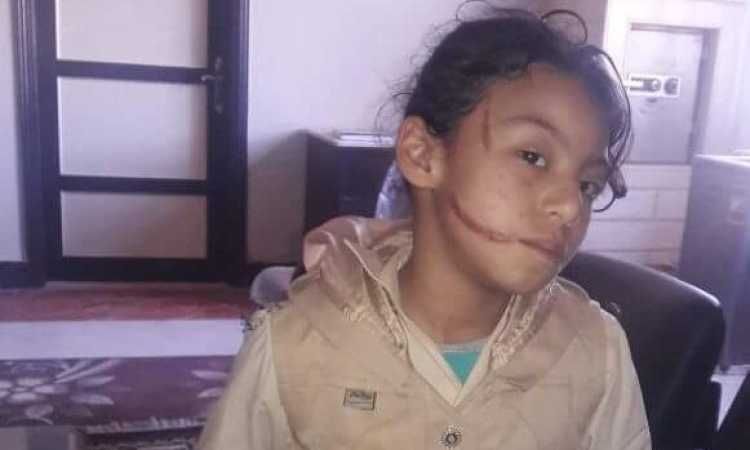 تعذيب طفلة 