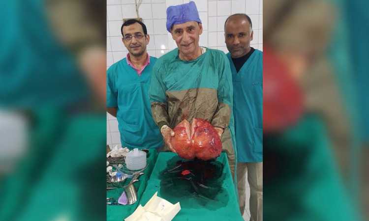 استئصال ورم يزن 20 كيلوجراما بمستشفى الإبراهيمية