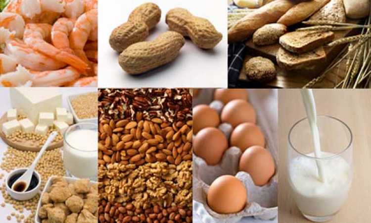 الحساسية الغذائية