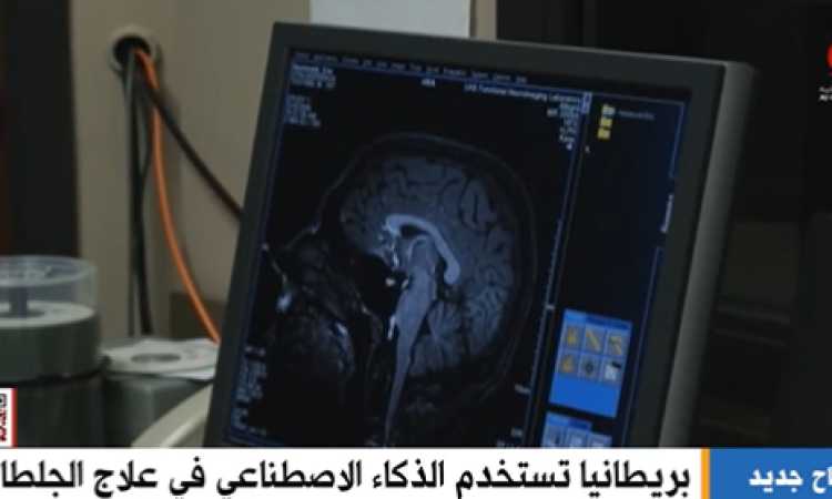 استخدام الذكاء الاصطناعى فى علاج الجلطات