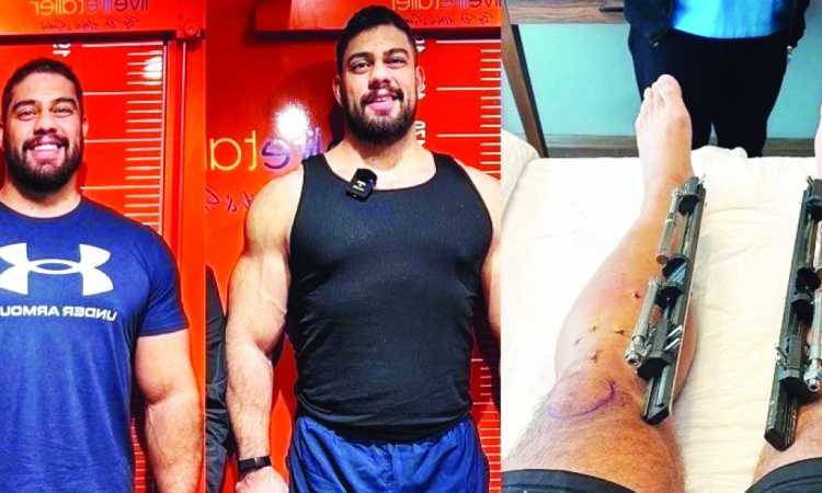 جراحة الساق