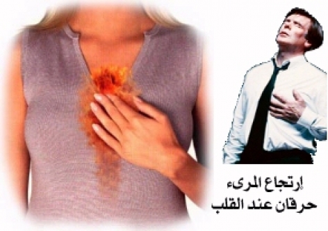 ارتجاع المرىء