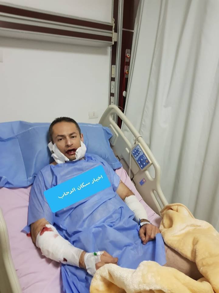 كلبان يعقران ضابط