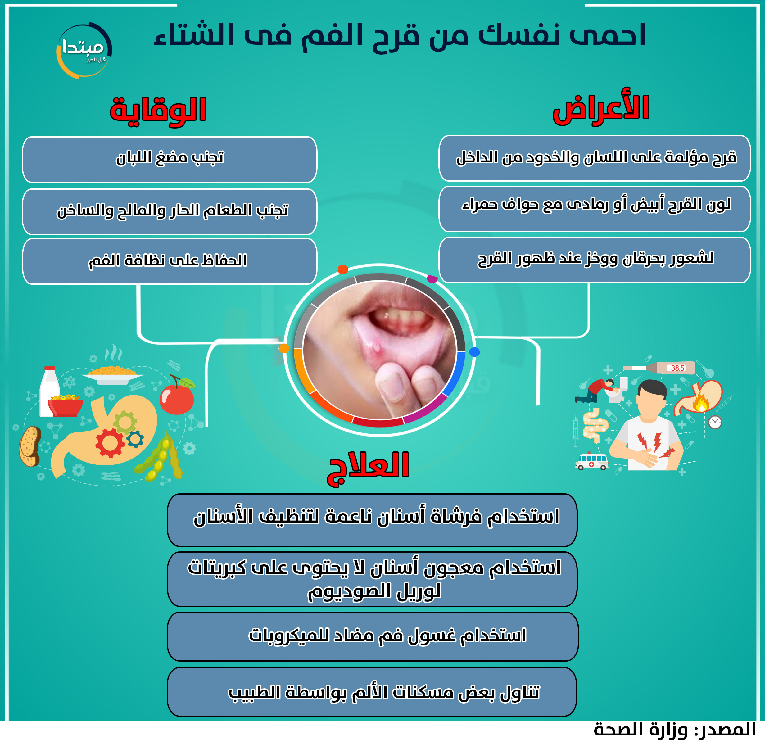 قرح الفم