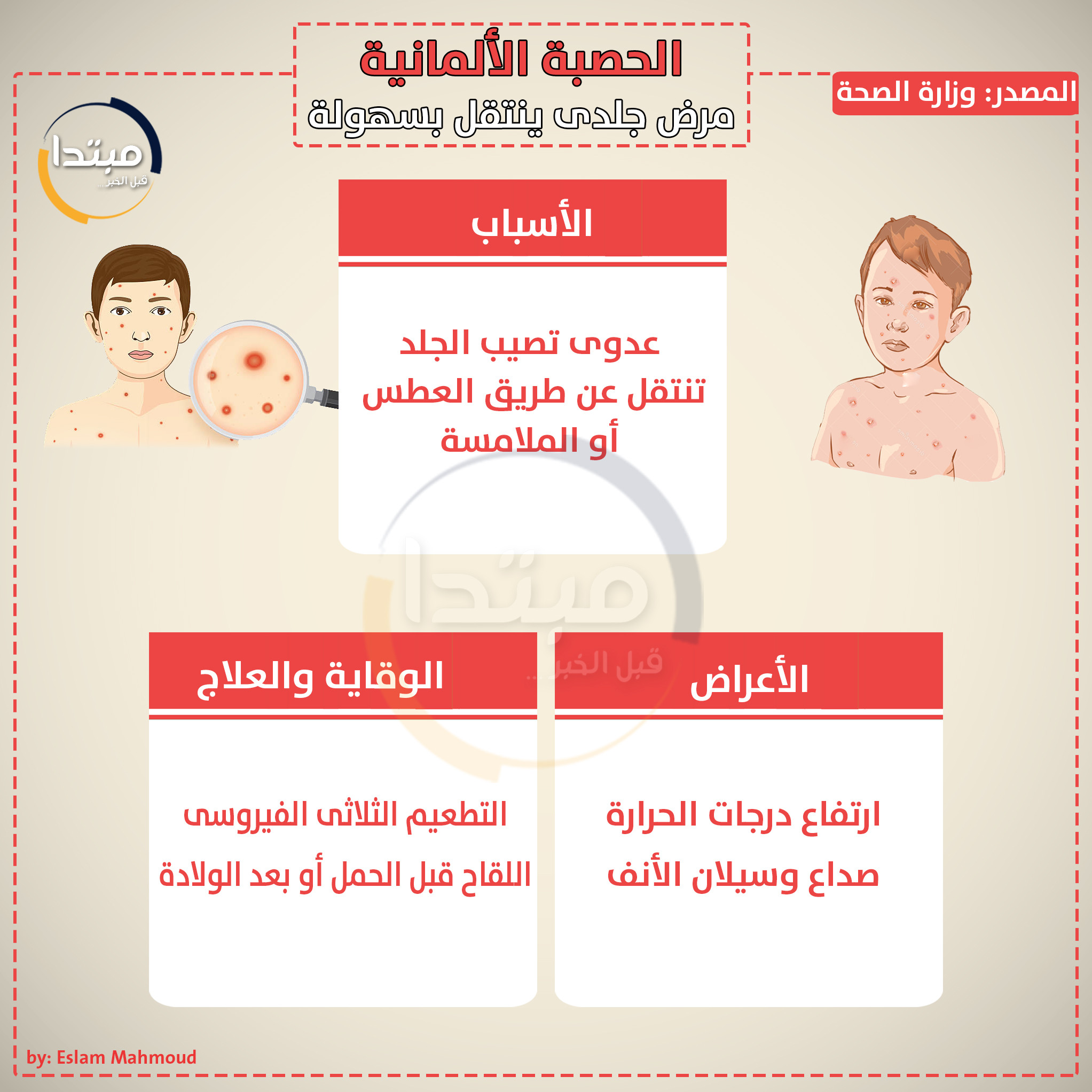الحصبة الألمانية