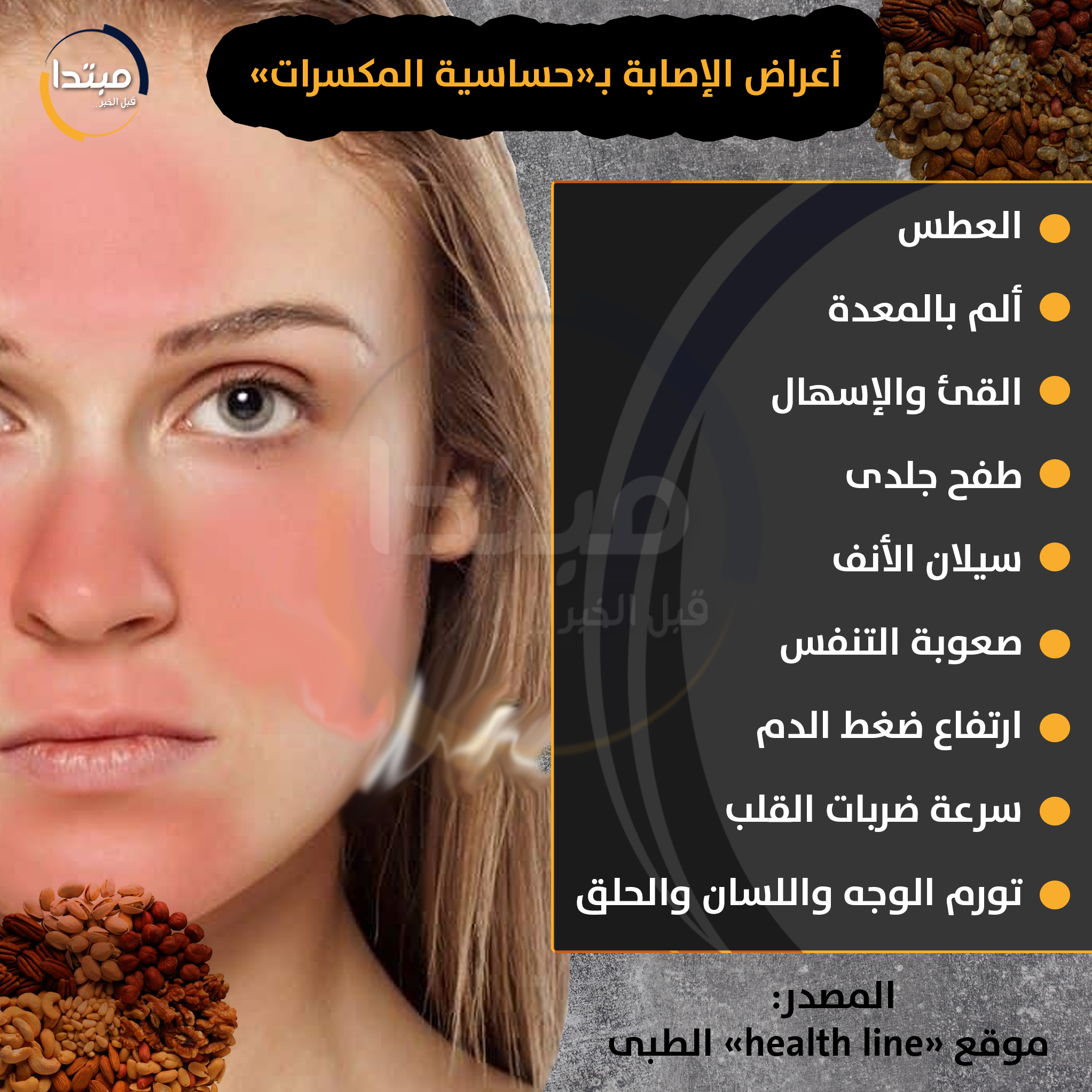 حساسية المكسرات