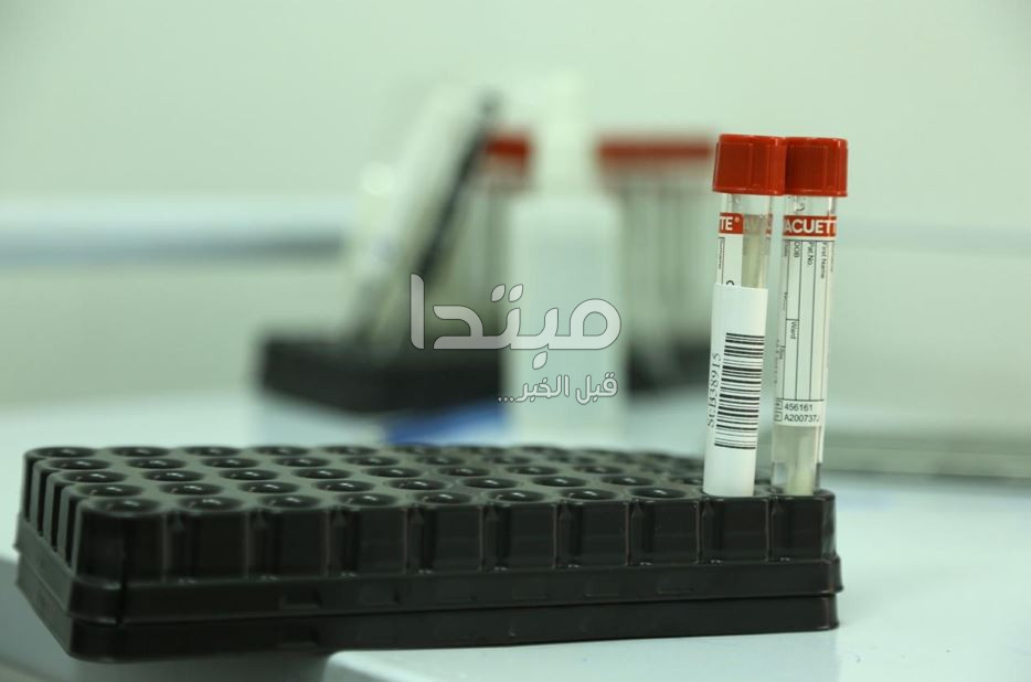 لقاح كورونا