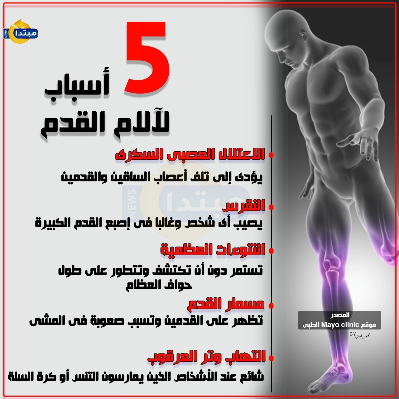 5 أسباب لآلام القدم