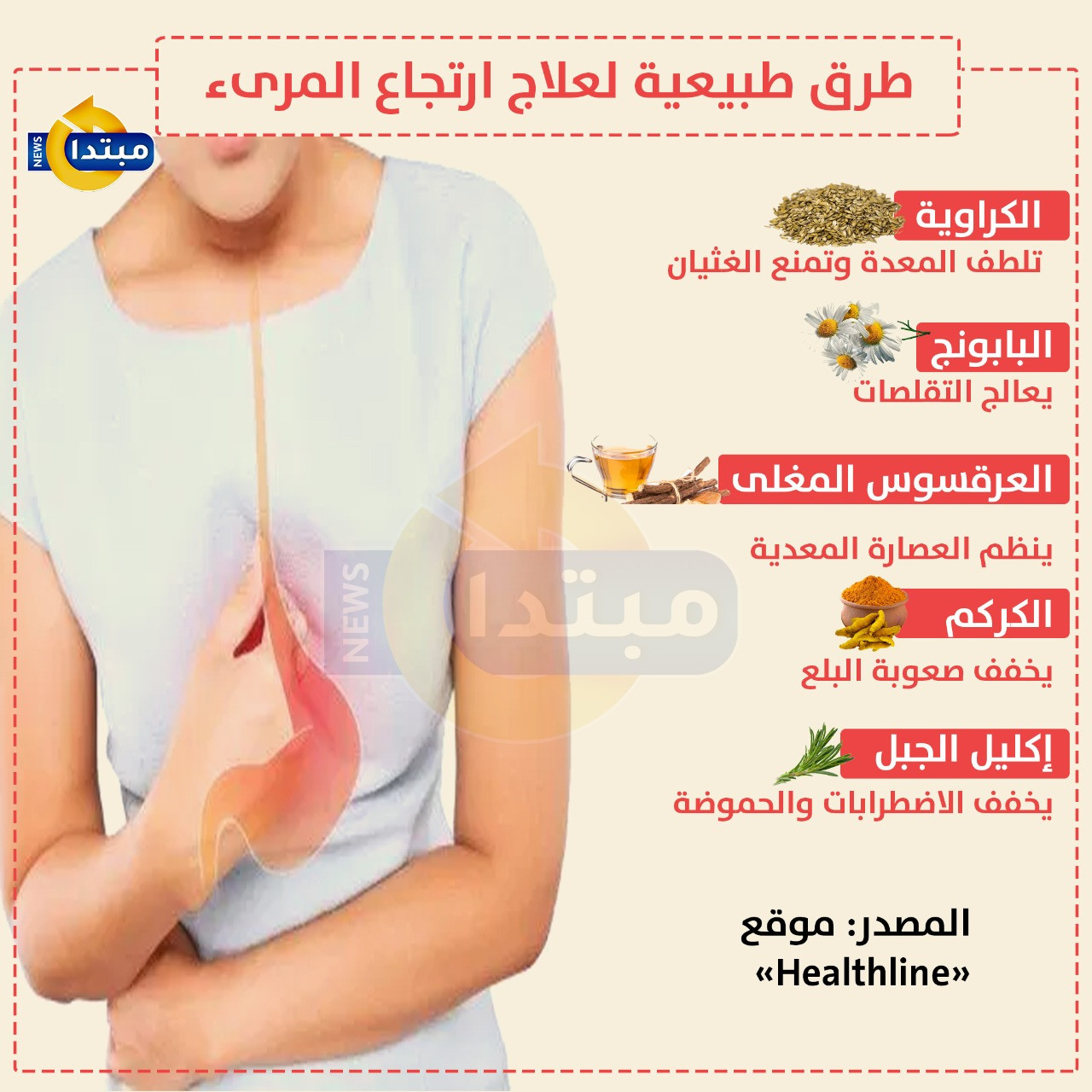 ارتجاع المرىء