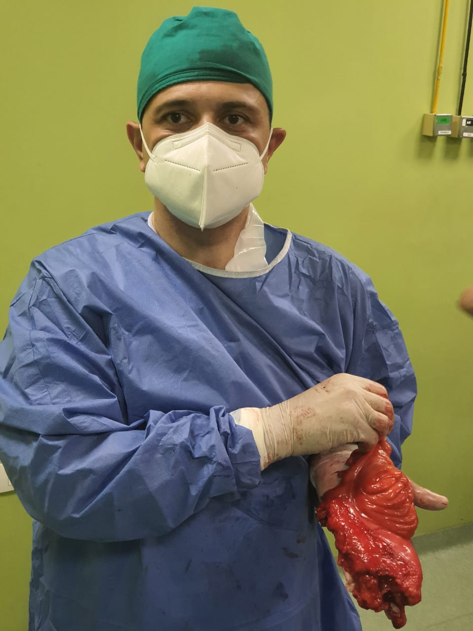 استئصال ورم بمستشفى منشية البكارى
