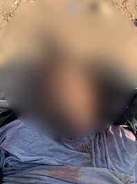 عناصر التشكيل العصابى فى أسوان