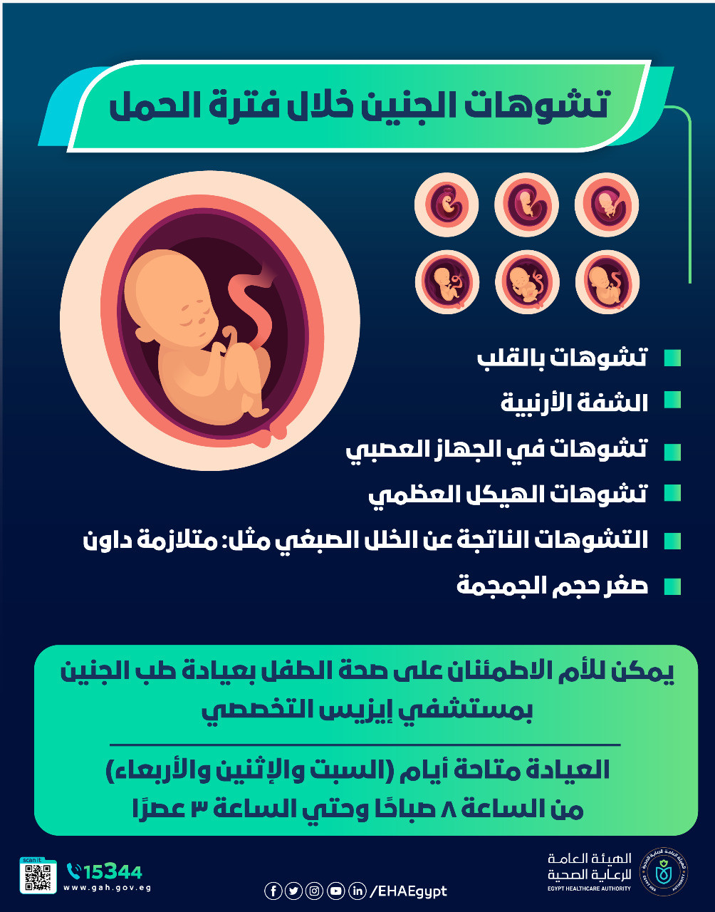 الإنفوجراف
