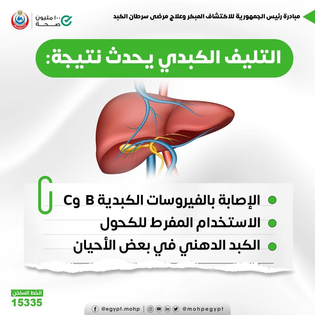 أسباب تؤدى إلى الإصابة بالتليف الكبدى