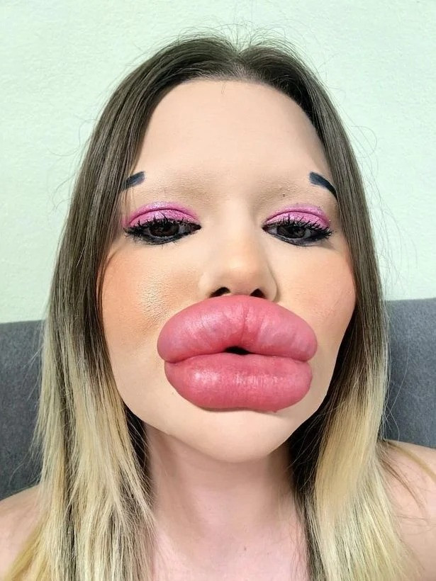 أكبر شفاه