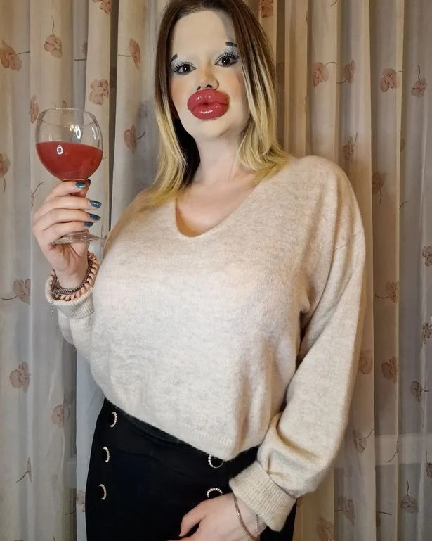 أكبر شفاه