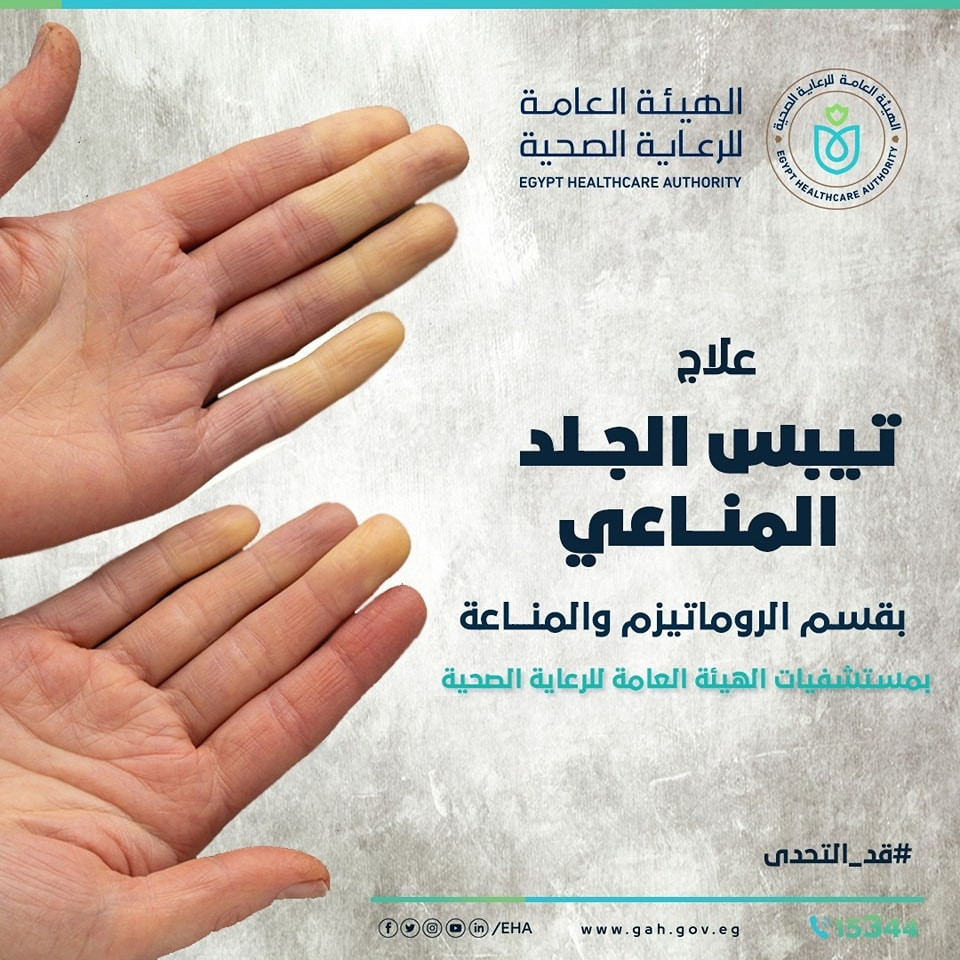 تيبس الجلد المناعى