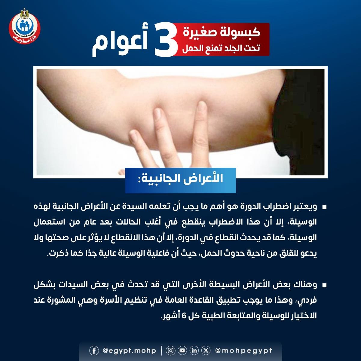 الكبسولة الصغيرة