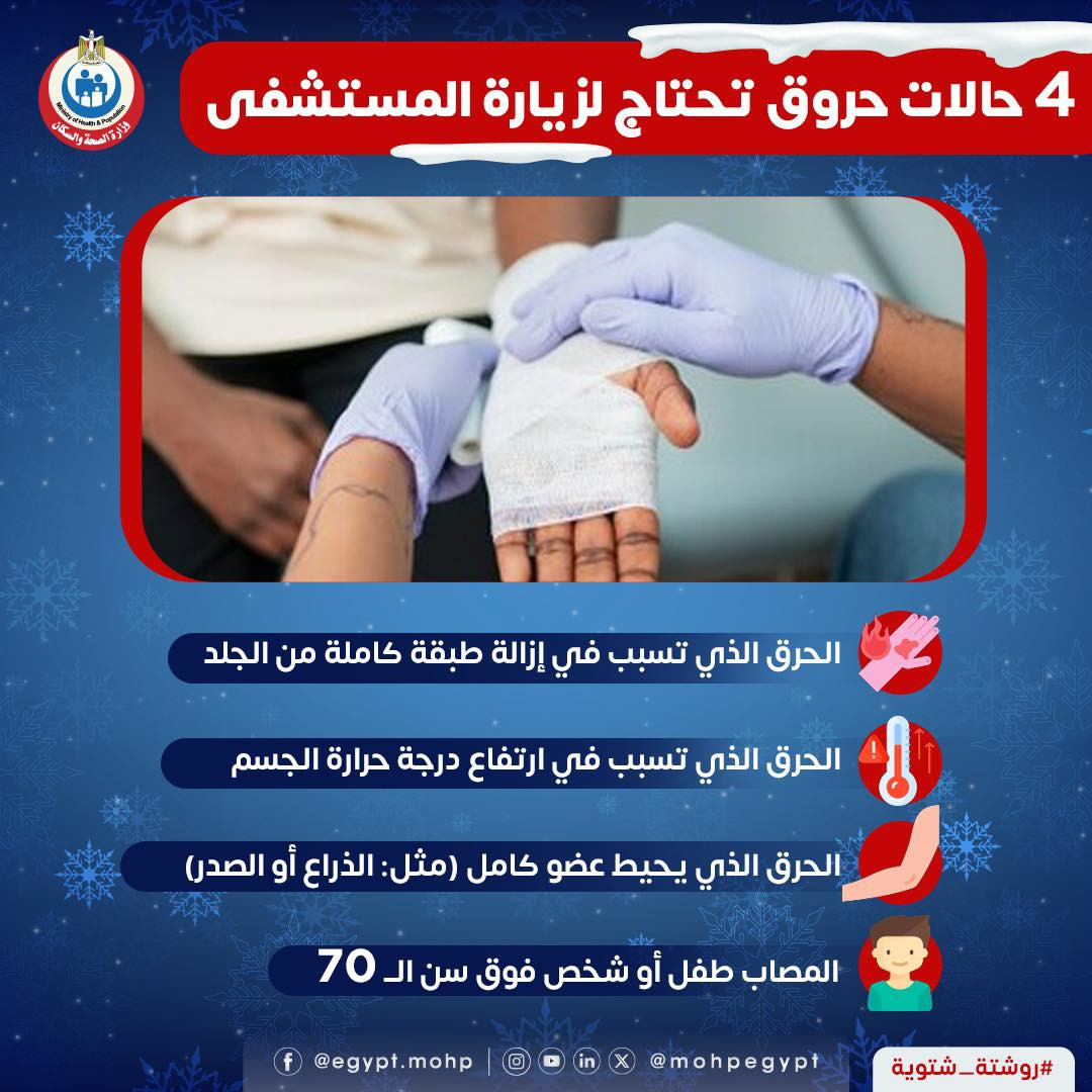 حالات حروق يجب عندها الذهاب للمستشفى فورا