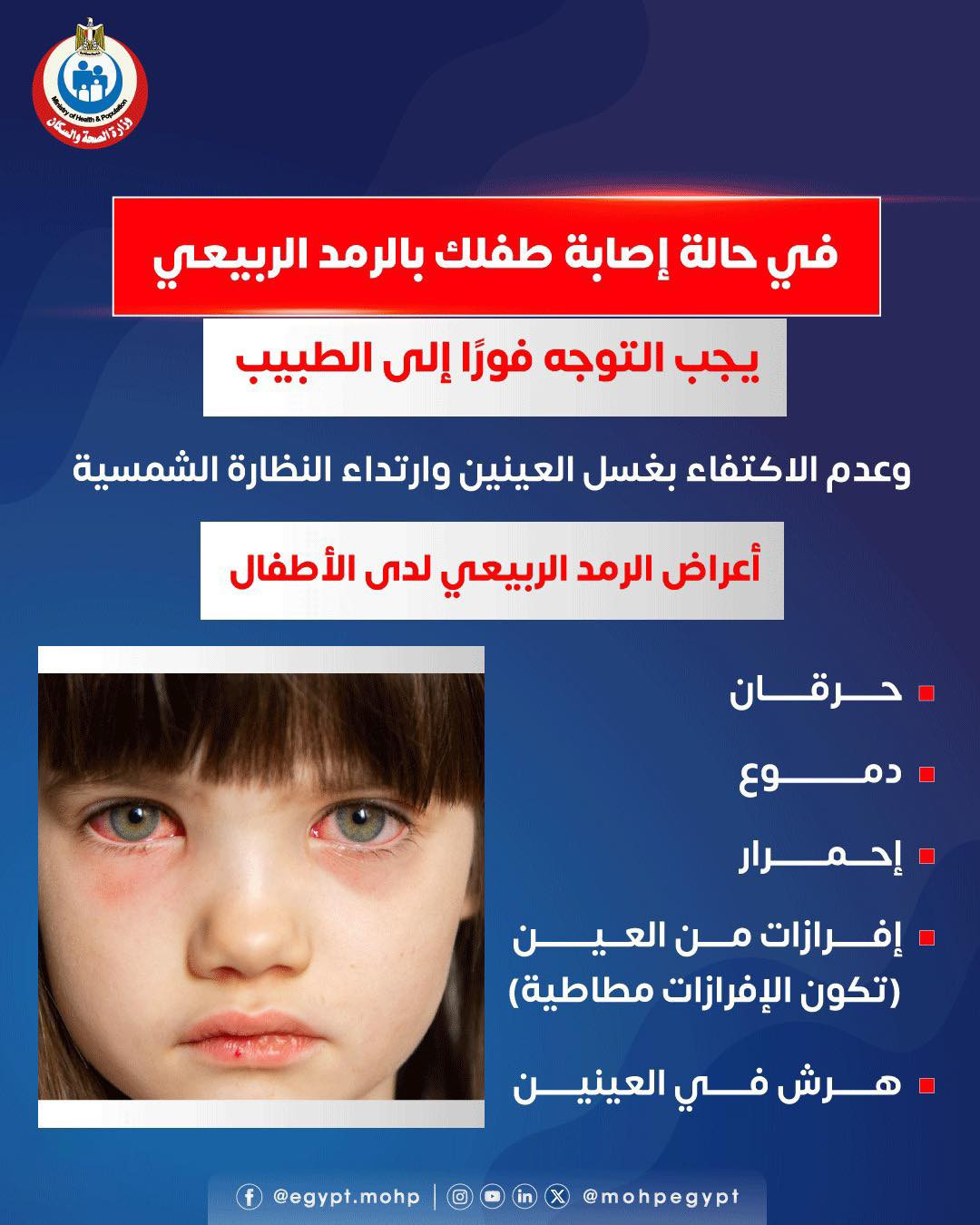 أعراض الرمد الربيعي عند الأطفال